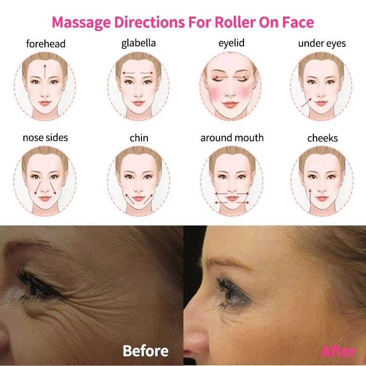 درمارولر پوست و مو وارداتی اورجینال | استاندارد پزشکی + میکرونیدلینگ خانگی + سوزنهای استیل ضدزنگ